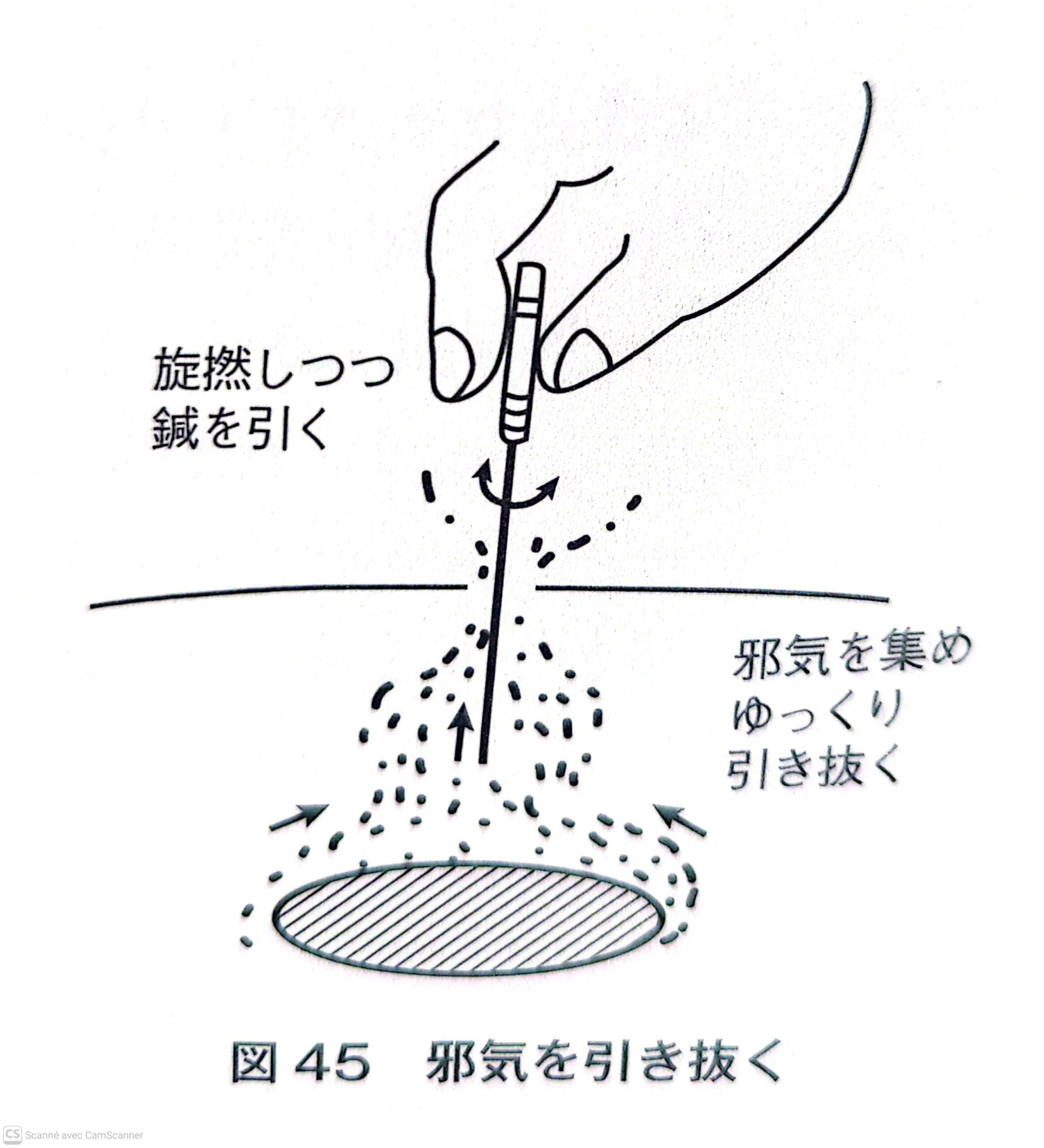 Exemple de l'examen palpatoire en Acupuncture Japonaise